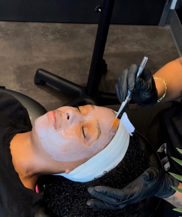 CHEMICAL PEELS