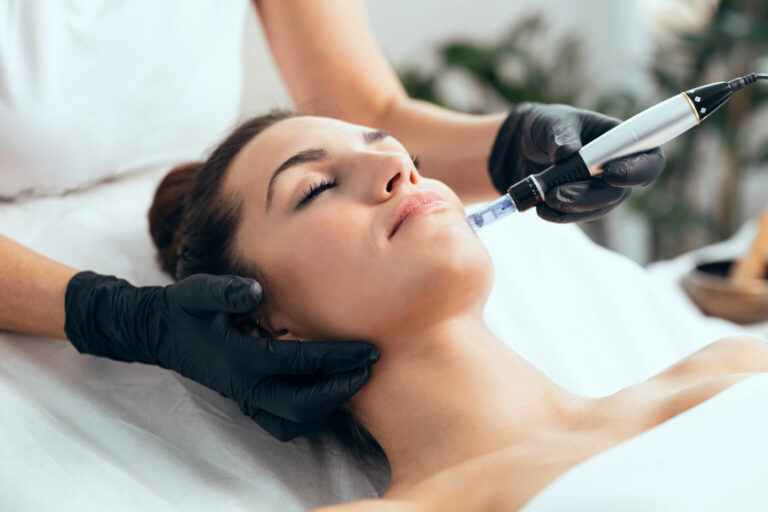 MICRONEEDLING