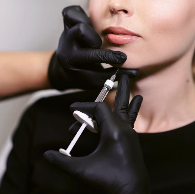 Dermal Fillers
